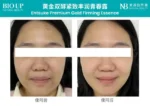 BIO UP entsuke premium gold essence testimonial